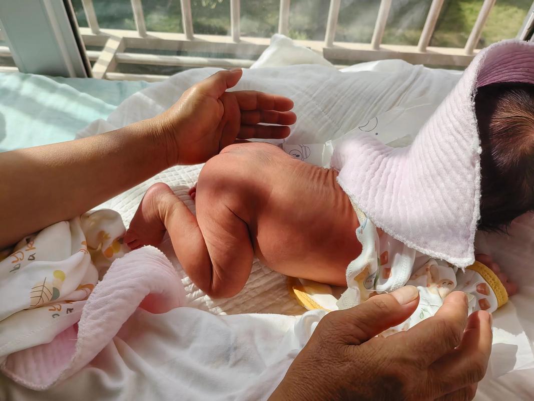 新生儿黄疸晒太阳要注意什么?正确方法和时间是怎样的?-第3张图片-郑州医学网 新生儿黄疸晒太阳要注意什么?正确方法和时间是怎样的?-第3张图片-郑州医学网