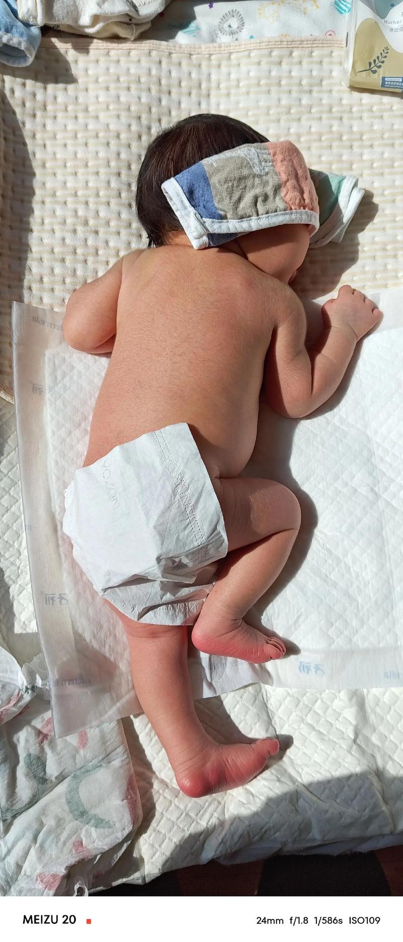 新生儿黄疸晒太阳要注意什么?正确方法和时间是怎样的?-第1张图片-郑州医学网 新生儿黄疸晒太阳要注意什么?正确方法和时间是怎样的?-第1张图片-郑州医学网