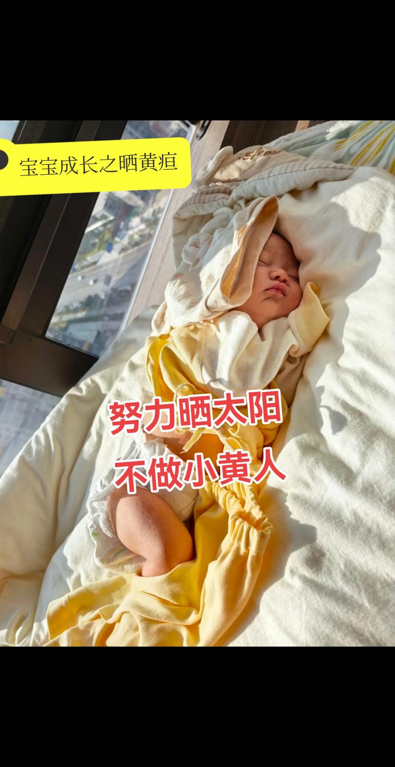 新生儿黄疸晒太阳要注意什么?正确方法和时间是怎样的?-第2张图片-郑州医学网 新生儿黄疸晒太阳要注意什么?正确方法和时间是怎样的?-第2张图片-郑州医学网