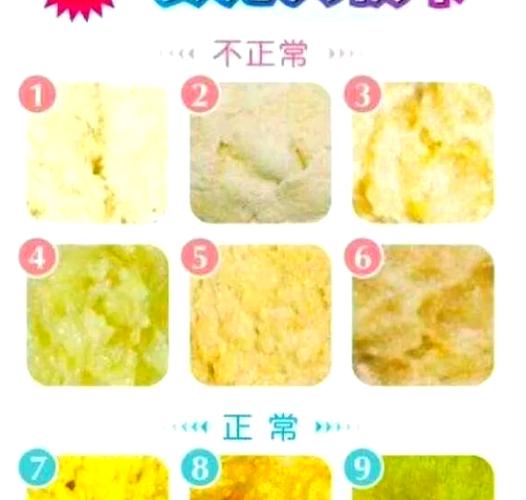 新生儿拉绿便便是消化不良还是生病信号?新手爸妈该如何应对?-第1张图片-郑州医学网 新生儿拉绿便便是消化不良还是生病信号?新手爸妈该如何应对?-第1张图片-郑州医学网