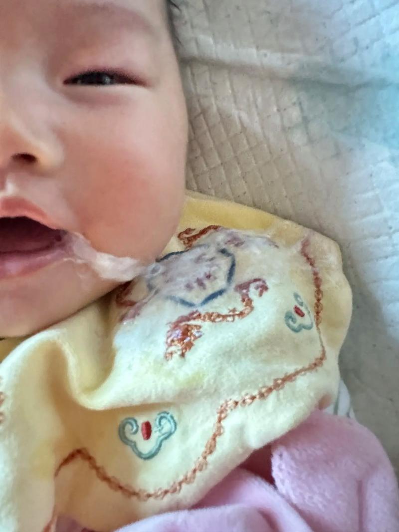 新生儿频繁使劲放屁又吐奶，是消化不良还是其他健康问题？-第2张图片-郑州医学网