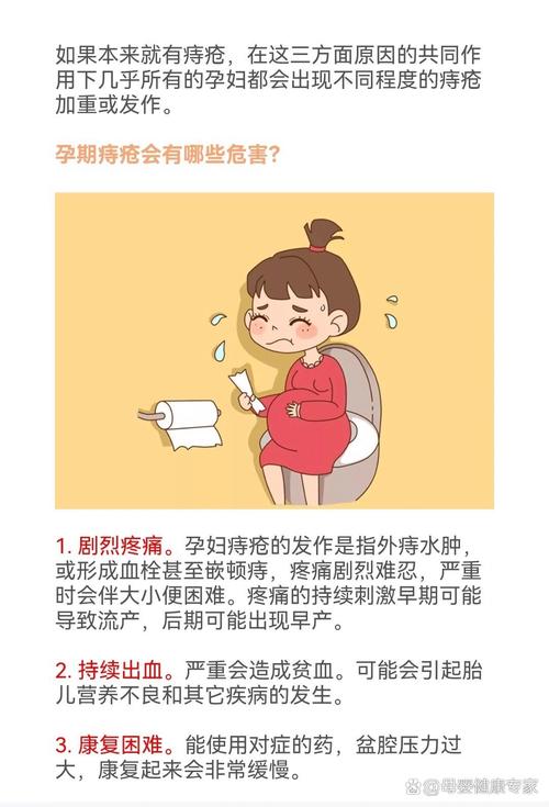 孕期肛门瘙痒又痔疮,坐立难安该如何缓解才安全?-第1张图片-郑州医学网 孕期肛门瘙痒又痔疮,坐立难安该如何缓解才安全?-第1张图片-郑州医学网