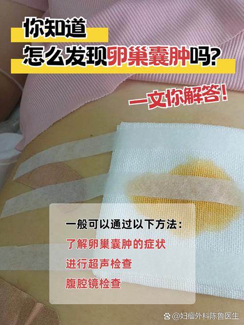 孕期卵巢囊肿会破裂吗?破裂风险高吗?对胎儿有影响吗?-第2张图片-郑州医学网 孕期卵巢囊肿会破裂吗?破裂风险高吗?对胎儿有影响吗?-第2张图片-郑州医学网