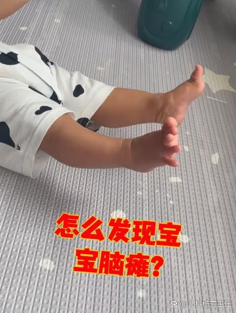 新生儿脑瘫早期信号有哪些？家长如何科学判断与干预？-第1张图片-郑州医学网