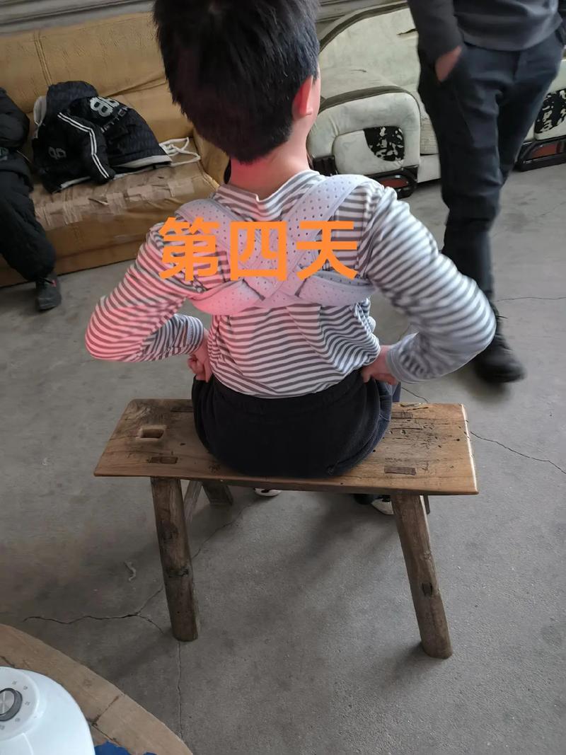 新生儿锁骨骨折后，家长该如何科学护理才能促进愈合并避免二次伤害？-第1张图片-郑州医学网