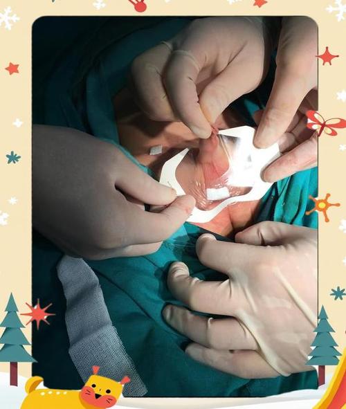 新生儿隐睾如何自然下降？家长需掌握哪些科学干预方法？-第3张图片-郑州医学网