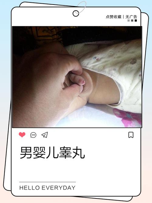 新生儿睾丸一个大一个小是正常现象吗?需要就医检查吗?-第2张图片-郑州医学网 新生儿睾丸一个大一个小是正常现象吗?需要就医检查吗?-第2张图片-郑州医学网