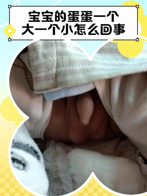 新生儿睾丸一个大一个小是正常现象吗?需要就医检查吗?-第1张图片-郑州医学网 新生儿睾丸一个大一个小是正常现象吗?需要就医检查吗?-第1张图片-郑州医学网