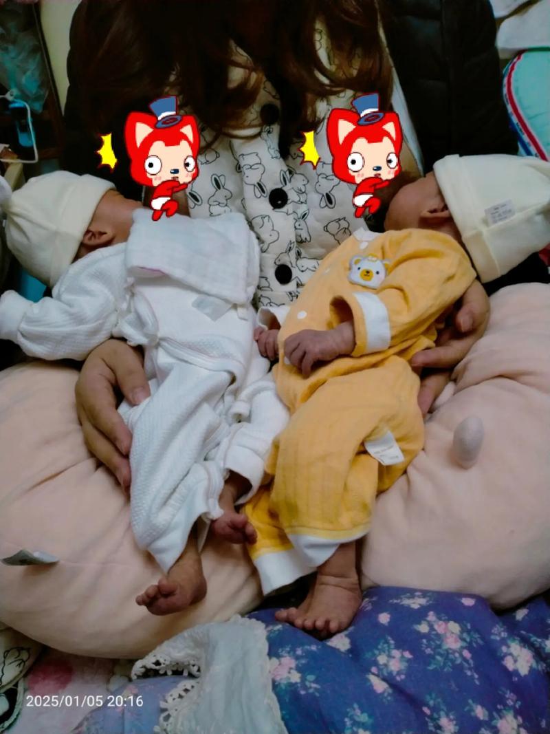 剖腹产宝宝出生第一天喂养，妈妈该注意哪些关键问题？-第2张图片-郑州医学网