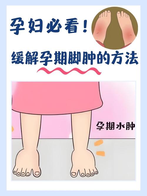 孕期后脚跟痛是什么原因导致的?需要特别关注吗?-第3张图片-郑州医学网 孕期后脚跟痛是什么原因导致的?需要特别关注吗?-第3张图片-郑州医学网