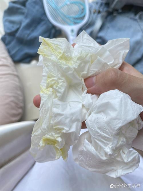 新生儿吐黄水是正常现象还是疾病信号?需要警惕哪些原因?-第1张图片-郑州医学网 新生儿吐黄水是正常现象还是疾病信号?需要警惕哪些原因?-第1张图片-郑州医学网