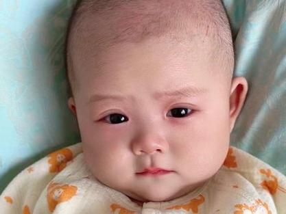 新生儿单双眼皮会随年龄变化吗？如何科学判断未来眼皮类型？-第2张图片-郑州医学网