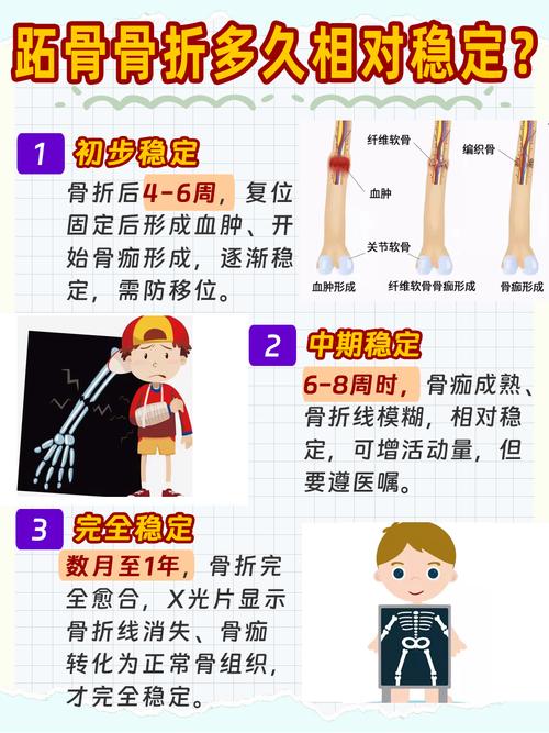 儿童最常见的骨折类型是什么？不同年龄段儿童骨折类型有何差异？-第2张图片-郑州医学网