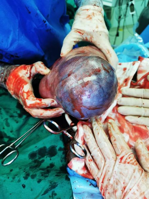 怀孕期间死胎会有哪些症状表现？孕妇该如何及时察觉异常？-第2张图片-郑州医学网