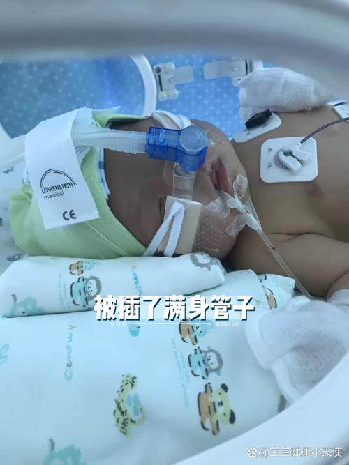 新生儿吸入性肺炎会留下哪些后遗症？如何早期发现与干预？-第2张图片-郑州医学网