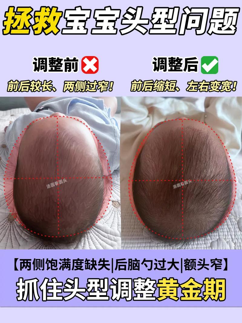 新生儿头颅为何会越睡越长？是生理发育还是睡姿影响的结果？-第1张图片-郑州医学网