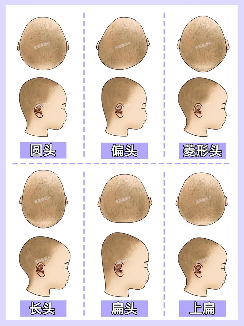 新生儿头颅为何会越睡越长？是生理发育还是睡姿影响的结果？-第2张图片-郑州医学网