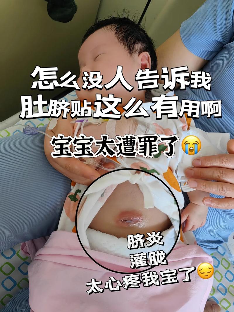 新生儿肚脐化脓了怎么办？如何正确处理与护理？-第2张图片-郑州医学网