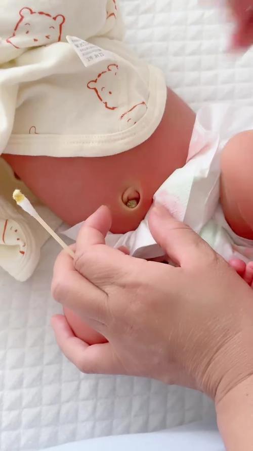 新生儿肚脐多久能完全长好？护理不当会感染吗？-第2张图片-郑州医学网