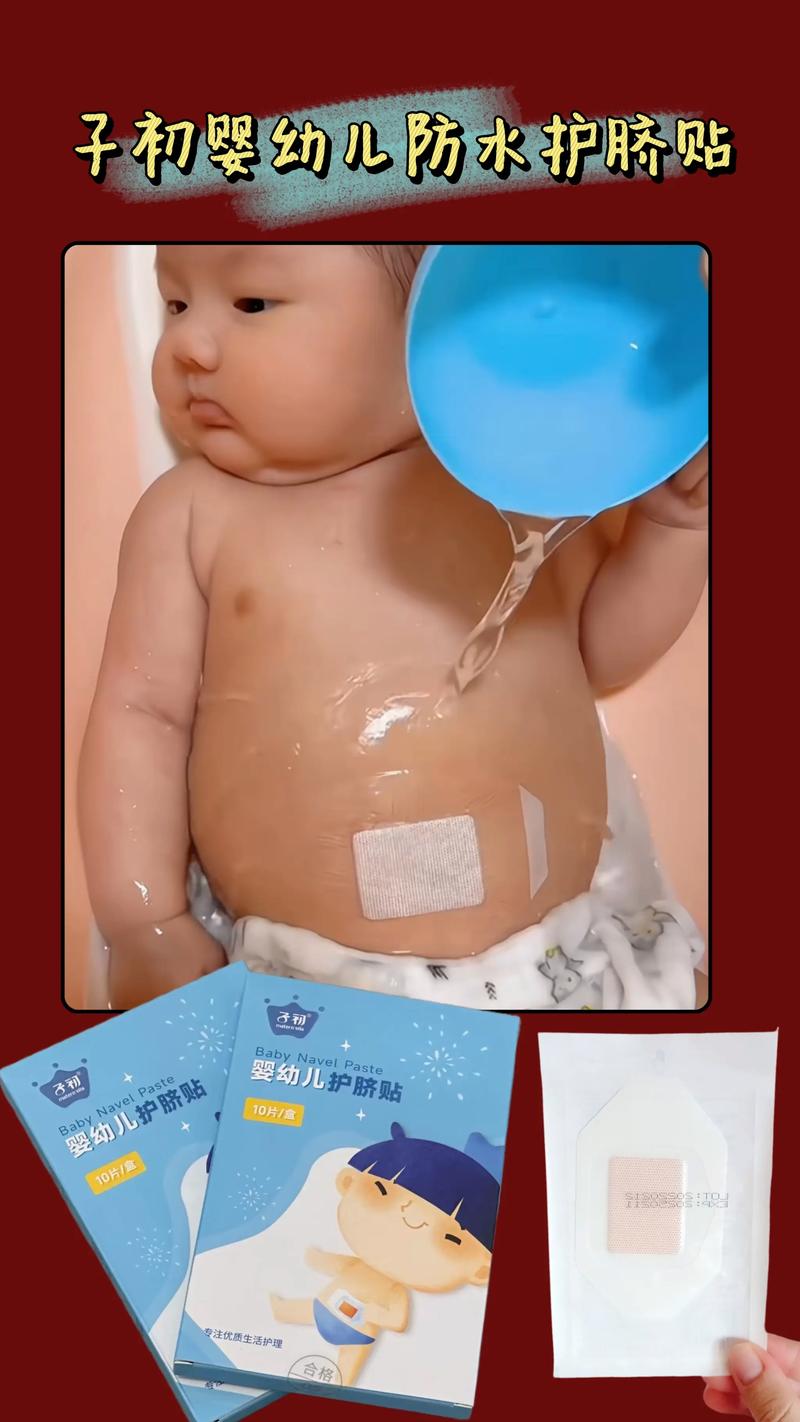 新生儿肚脐多久能完全长好?护理不当会感染吗?-第1张图片-郑州医学网 新生儿肚脐多久能完全长好?护理不当会感染吗?-第1张图片-郑州医学网