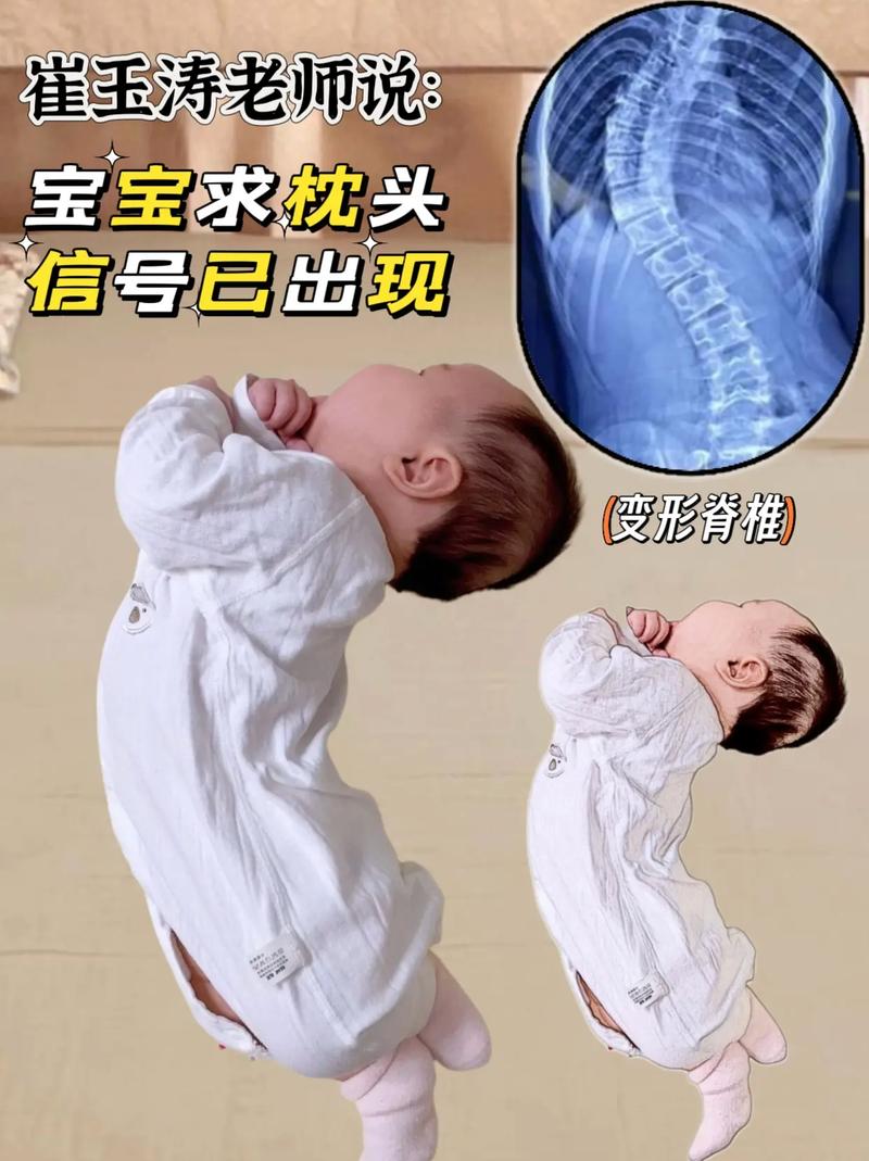 新生儿到底几个月可以开始安全使用枕头?新手爸妈必看的关键时间点与注意事项!-第2张图片-郑州医学网 新生儿到底几个月可以开始安全使用枕头?新手爸妈必看的关键时间点与注意事项!-第2张图片-郑州医学网