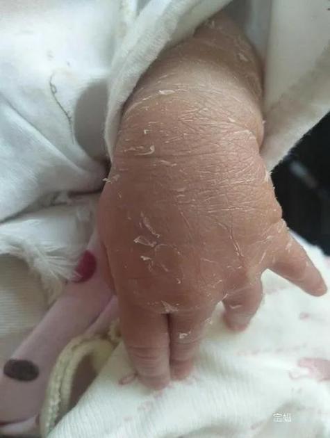 新生儿手脚冰凉是正常现象还是健康预警?体温调节机制有何特别之处?-第2张图片-郑州医学网 新生儿手脚冰凉是正常现象还是健康预警?体温调节机制有何特别之处?-第2张图片-郑州医学网