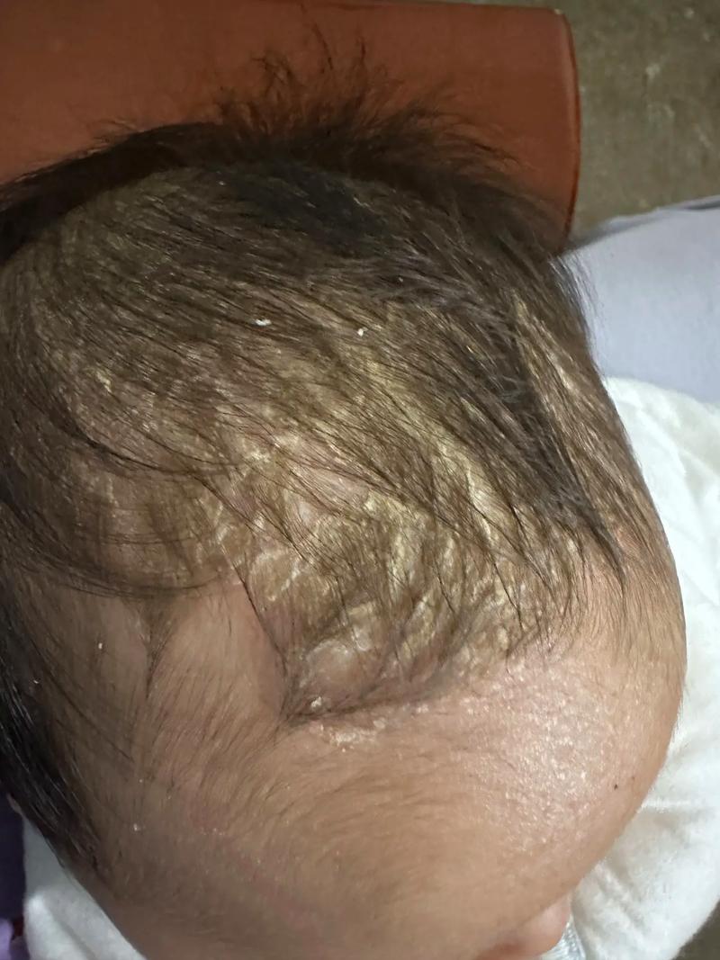 新生儿脑发育不良有哪些典型表现？家长该如何早期识别与干预？-第3张图片-郑州医学网