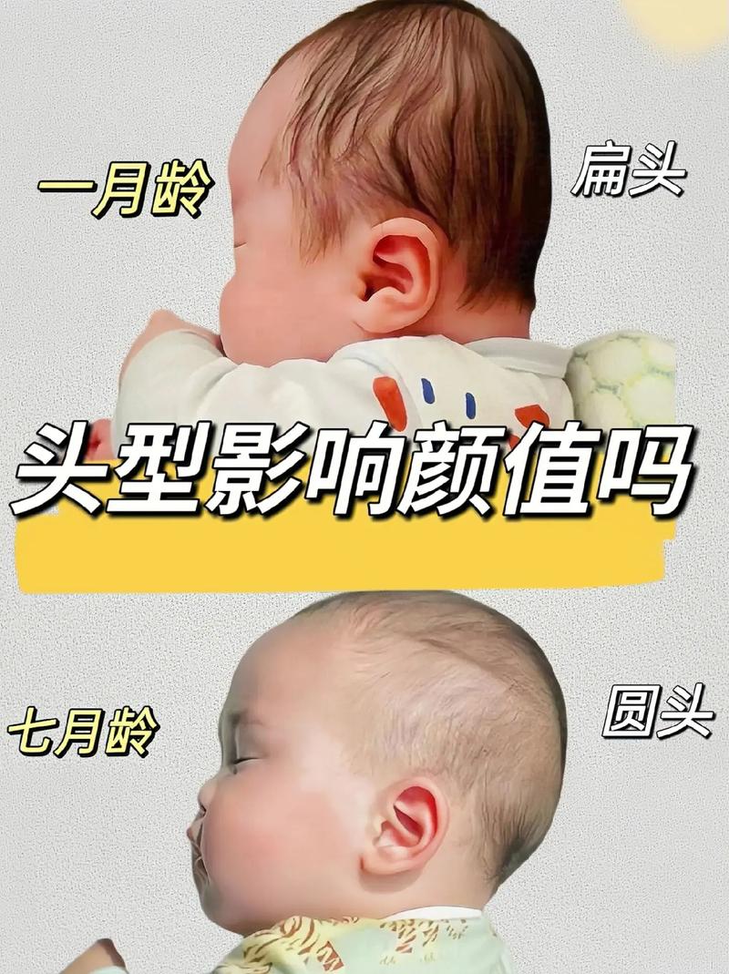 儿童扁头发型有哪些款式？不同脸型适合哪种扁头造型？-第1张图片-郑州医学网