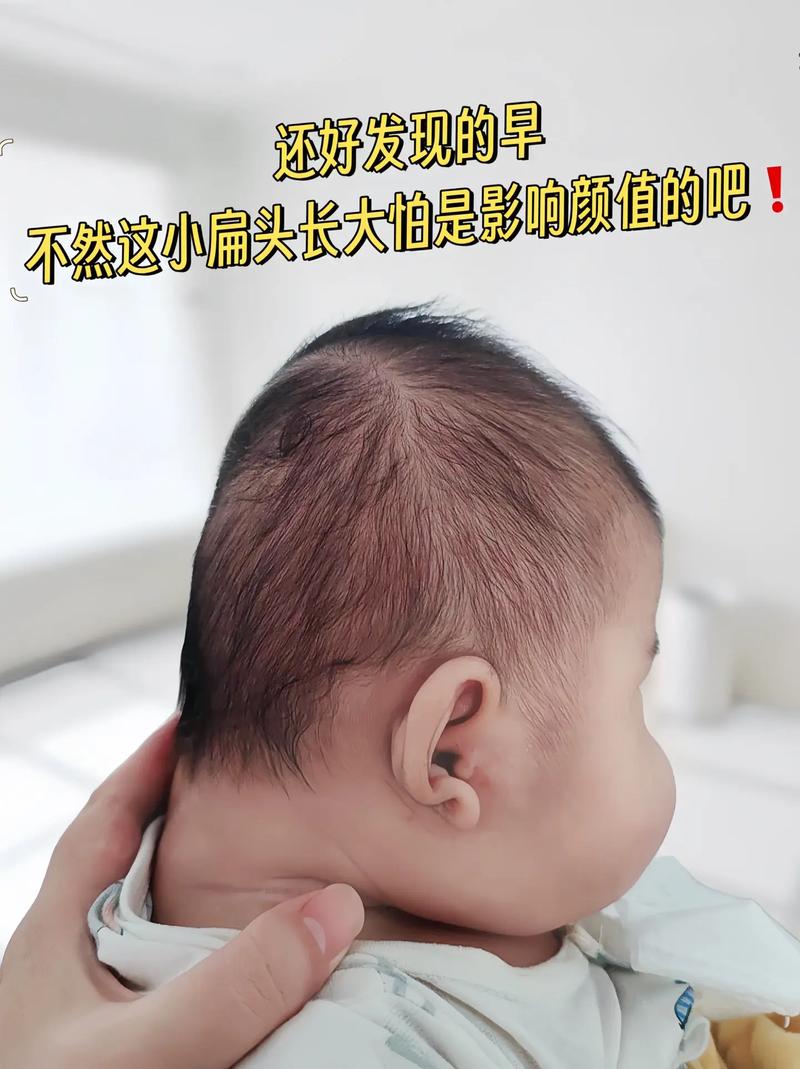 儿童扁头发型有哪些款式？不同脸型适合哪种扁头造型？-第3张图片-郑州医学网