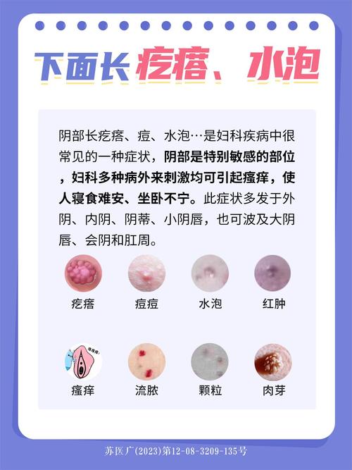 孕期私密处瘙痒，是激素变化还是感染预警？如何科学应对才安全？-第2张图片-郑州医学网