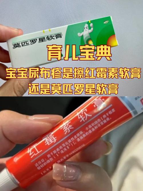 新生儿湿疹安全用药指南，哪些药能缓解，哪些药要避开？-第2张图片-郑州医学网