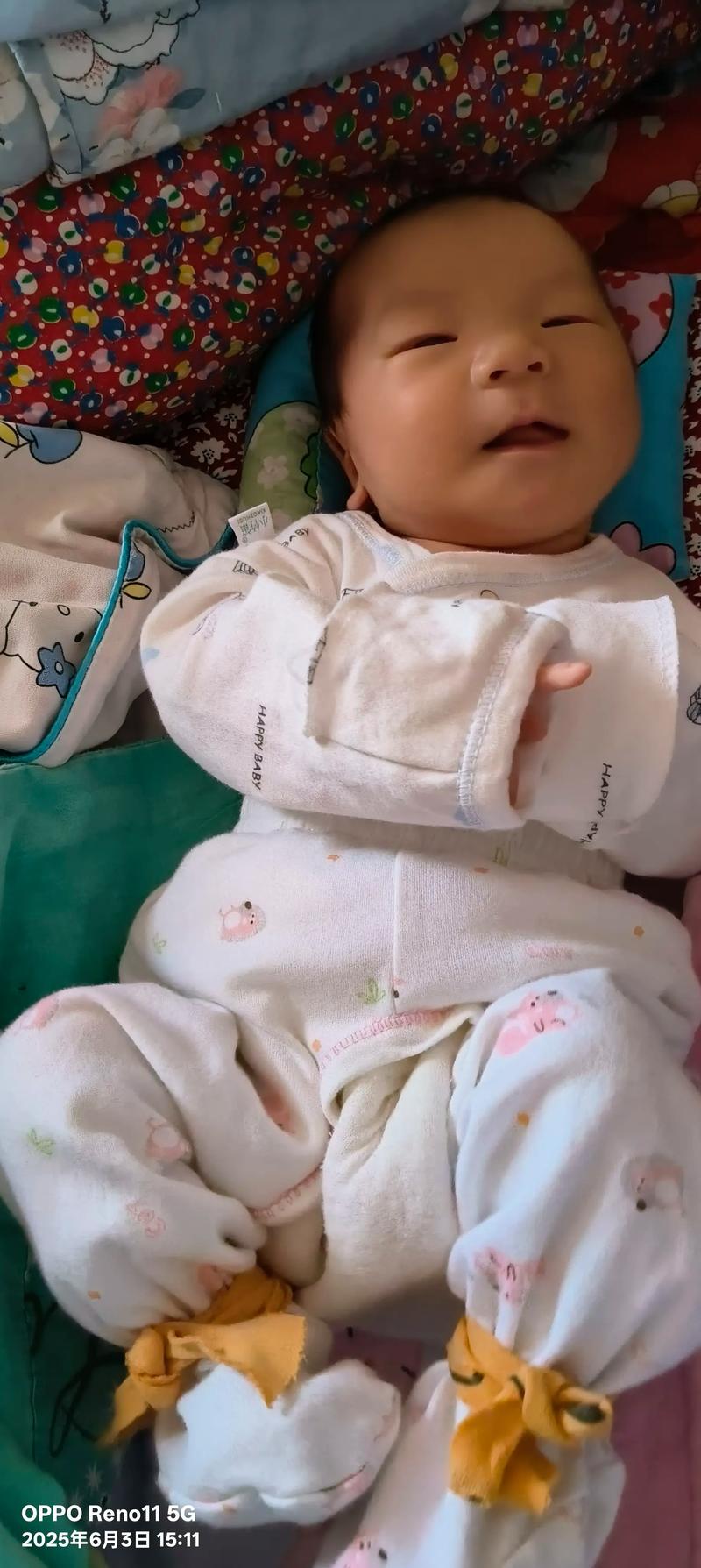 刚出生10天的宝宝视力范围有多大？能看清多远的物体呢？-第2张图片-郑州医学网