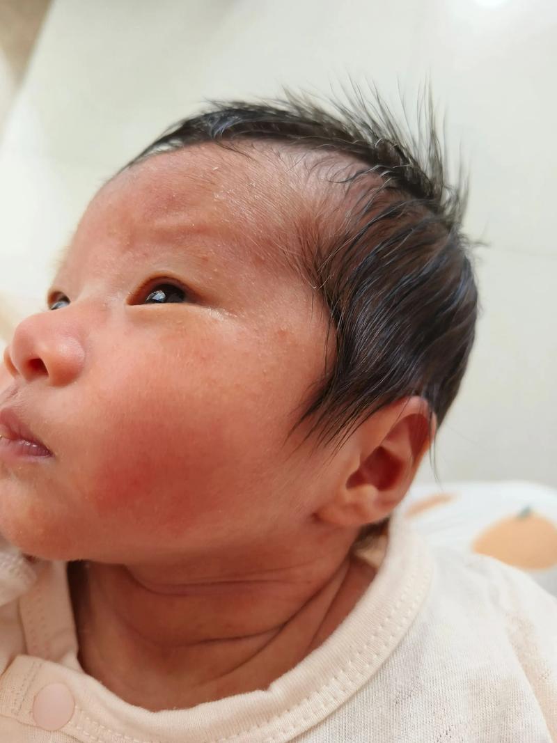 新生儿20多天黄疸还没退，是病理性黄疸还是喂养方式有问题？-第2张图片-郑州医学网