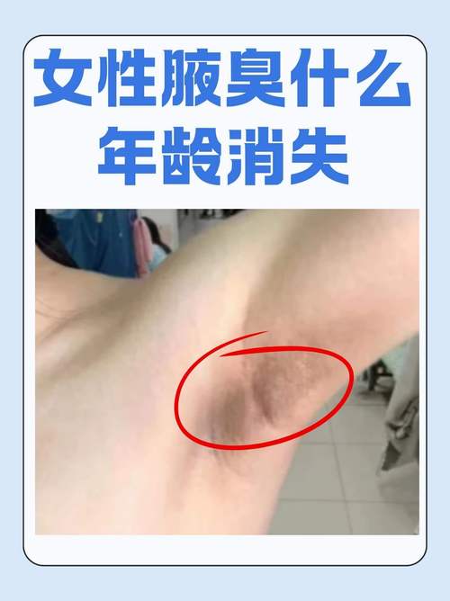 孕期腋下异味是激素变化还是代谢异常?该怎么护理缓解?-第2张图片-郑州医学网 孕期腋下异味是激素变化还是代谢异常?该怎么护理缓解?-第2张图片-郑州医学网