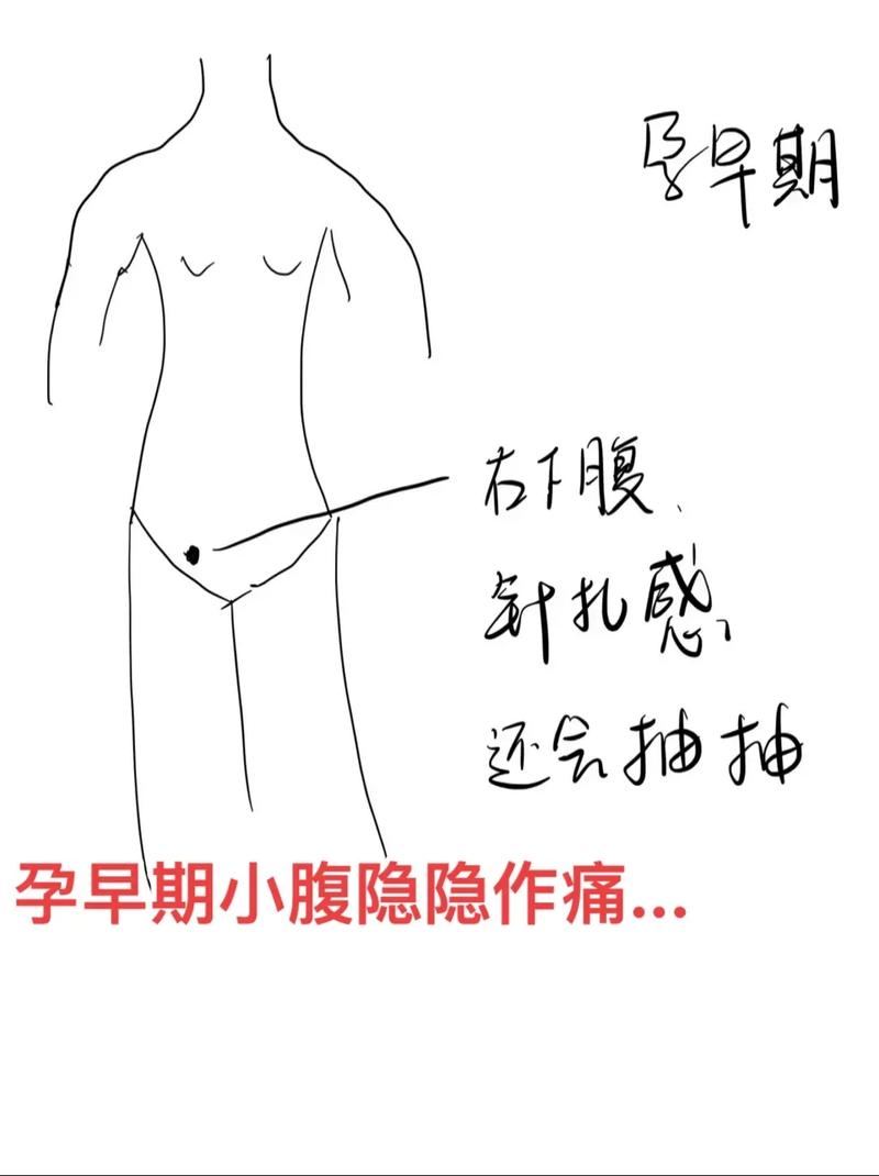 孕期小腹右边隐隐作痛，是正常生理反应还是需警惕的异常信号？-第2张图片-郑州医学网