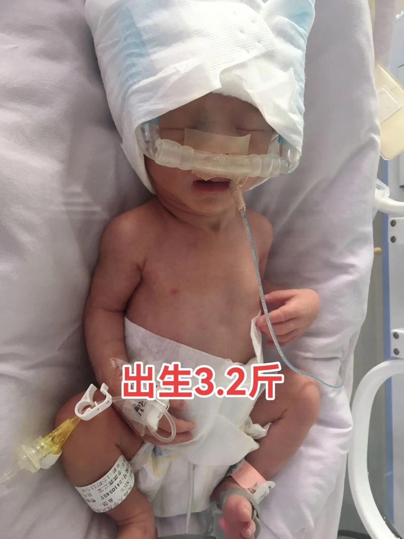 新生儿保温箱价格差异大，不同功能配置的型号价格是多少？-第2张图片-郑州医学网