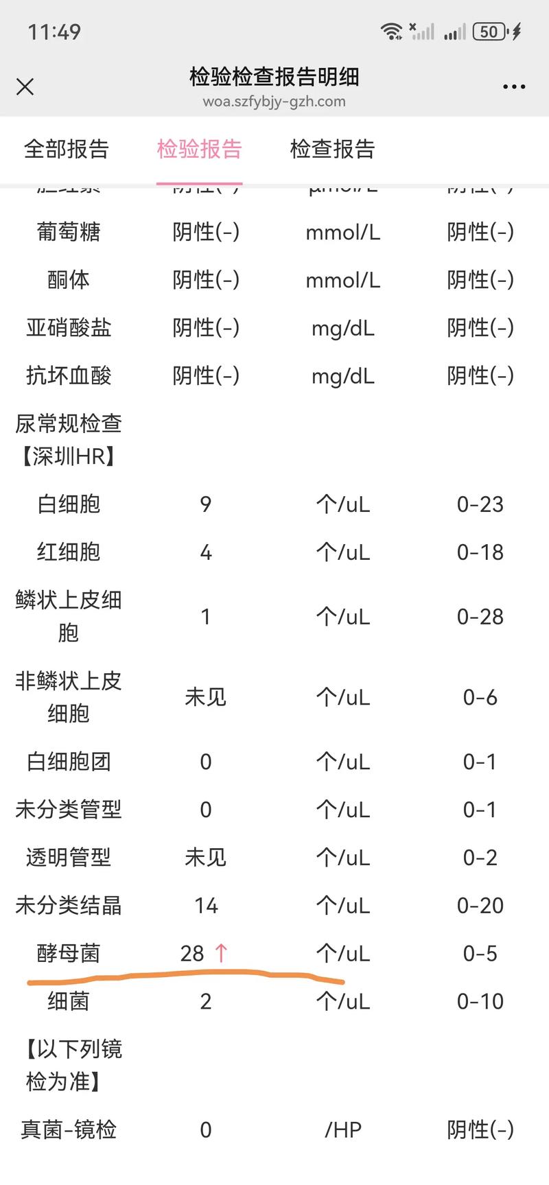 孕期尿检pH值偏高或偏低意味着什么？对胎儿健康有影响吗？-第3张图片-郑州医学网