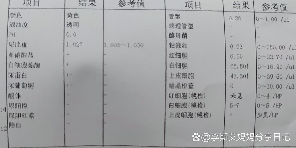 孕期尿检pH值偏高或偏低意味着什么？对胎儿健康有影响吗？-第1张图片-郑州医学网