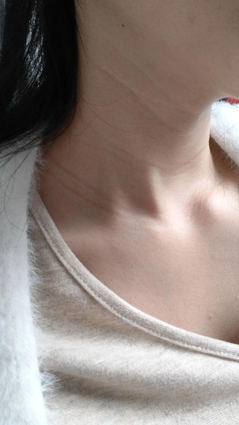 孕期脖子变黑会自己慢慢恢复吗？需要做些什么来加速改善呢？-第1张图片-郑州医学网