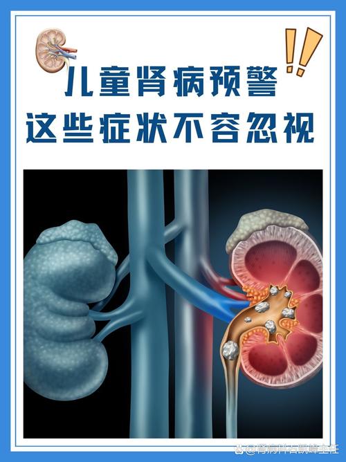 儿童肾积水早期症状隐匿，家长该如何识别异常信号？-第1张图片-郑州医学网