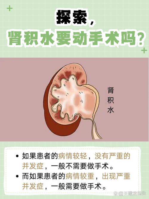 儿童肾积水早期症状隐匿，家长该如何识别异常信号？-第2张图片-郑州医学网
