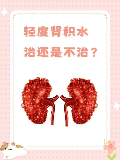 儿童肾积水早期症状隐匿，家长该如何识别异常信号？-第3张图片-郑州医学网