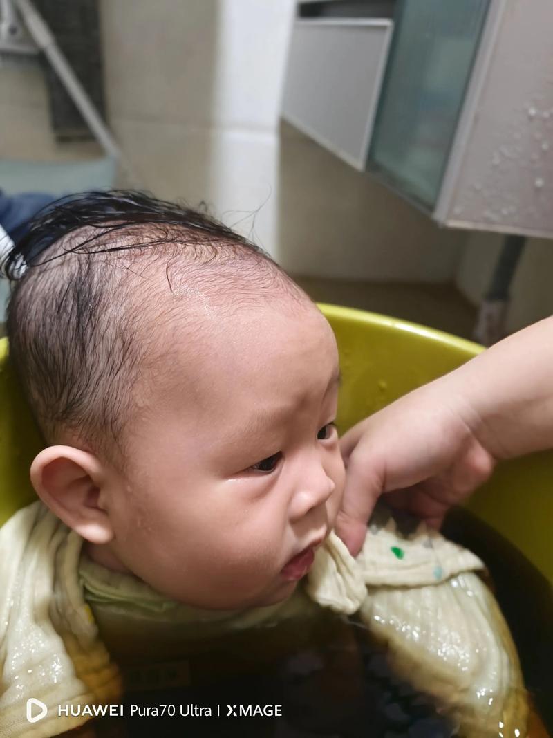 新生儿真的适合用艾叶水洗澡吗？潜在风险与科学依据是什么？-第2张图片-郑州医学网