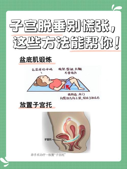 孕期如何有效预防子宫脱垂?有哪些科学方法能降低风险?-第2张图片-郑州医学网 孕期如何有效预防子宫脱垂?有哪些科学方法能降低风险?-第2张图片-郑州医学网