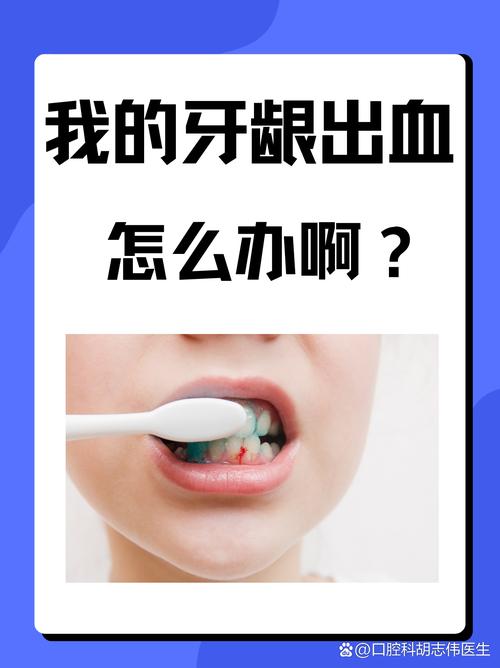 孕期牙齿出血是身体发出的危险信号吗？该如何科学应对与预防？-第1张图片-郑州医学网