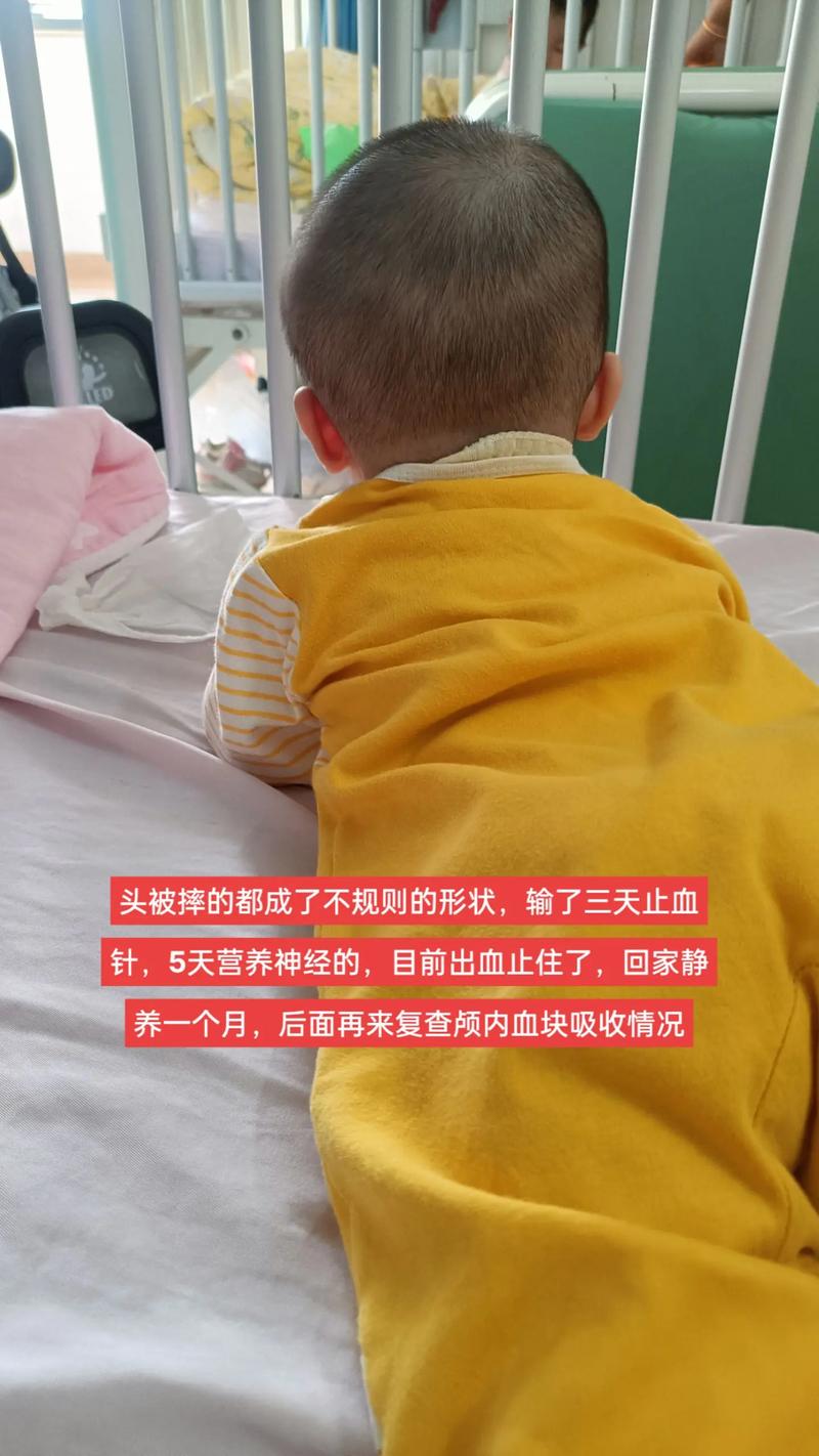 新生儿颅内出血的临床表现有哪些具体特征及早期识别要点？-第1张图片-郑州医学网