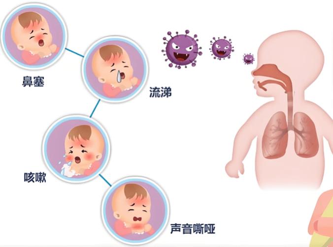 新生儿急性上呼吸道感染有哪些典型症状与护理要点？-第3张图片-郑州医学网