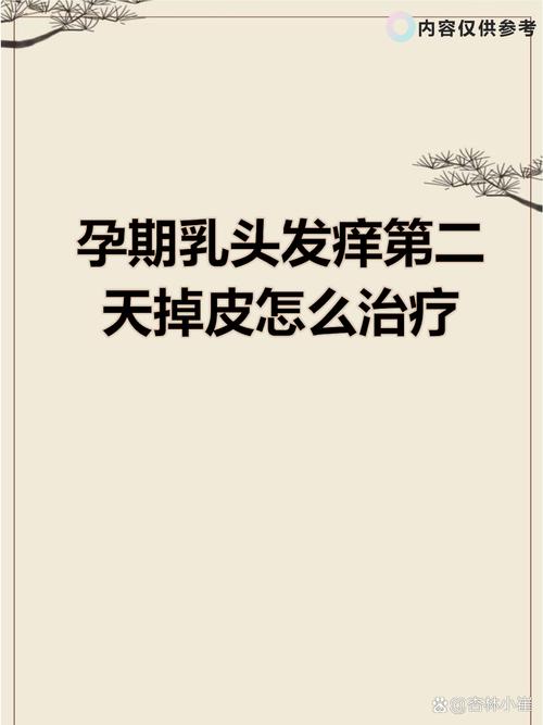 孕期乳头掉皮是正常现象吗？需要警惕哪些疾病风险？-第1张图片-郑州医学网