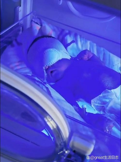 新生儿黄疸照蓝光费用差异大，不同地区和医院收费标准有何不同？-第3张图片-郑州医学网