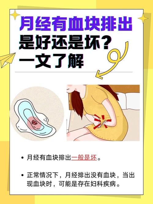 宫外孕期间会来月经吗？出血和月经的区别是什么？-第3张图片-郑州医学网